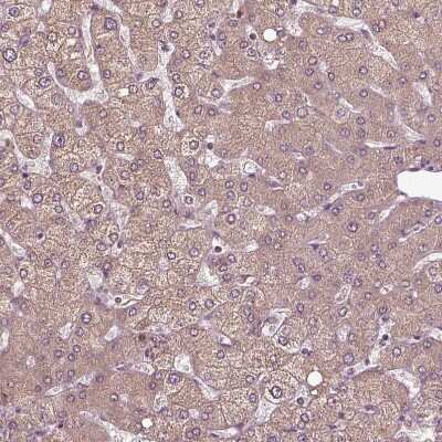 Immunohistochemistry-Paraffin: ERV3-1 Antibody [NBP2-62602] - Staining of human liver shows very weak cytoplasmic positivity in hepatocytes.