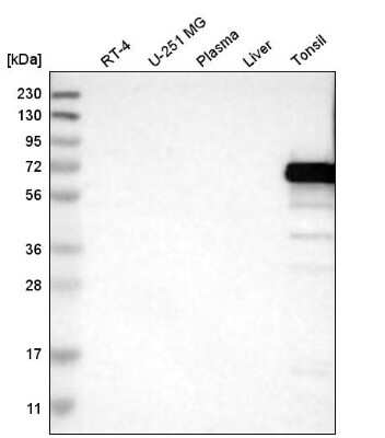 <b>Orthogonal Strategies Validation. </b>Western Blot: ERV3-1 Antibody [NBP2-62602] - Analysis in human cell line RT-4, human cell line U-251 MG, human plasma, human liver tissue and human tonsil tissue.