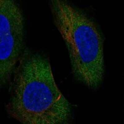 Immunocytochemistry/Immunofluorescence: ERVV-1 Antibody [NBP3-17159] - Staining of human cell line SuSa shows localization to cytosol & centrosome.