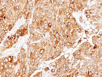 Immunohistochemistry-Paraffin: ERp57 Antibody [NBP2-16370] - Immunohistochemical analysis of paraffin-embedded BT474 xenograft, using antibody at 1:100 dilution.