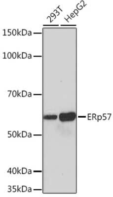 Western Blot: ERp57/PDIA3 Antibody (9S9X4) [NBP3-16394] - Western blot analysis of extracts of various cell lines, using ERp57/PDIA3 Rabbit mAb (NBP3-16394) at 1:1000 dilution. Secondary antibody: HRP Goat Anti-Rabbit IgG (H+L) at 1:10000 dilution. Lysates/proteins: 25ug per lane. Blocking buffer: 3% nonfat dry milk in TBST. Detection: ECL Basic Kit. Exposure time: 10s.