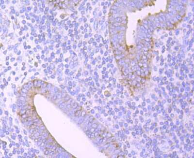 Immunohistochemistry-Paraffin: ERp57/PDIA3 Antibody (JM11-44) [NBP2-66824] - Analysis of paraffin-embedded human uterus tissue using anti-ERp57 antibody. Counter stained with hematoxylin.