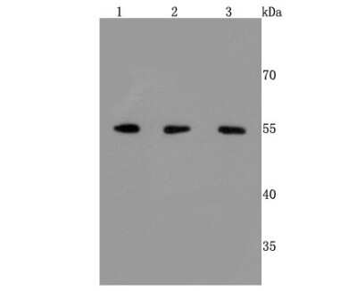 Western Blot: ERp57/PDIA3 Antibody (JM11-44) [NBP2-66824] - Analysis of ERp57 on different cells lysates using anti-ERp57 antibody at 1/500 dilution. Positive control: Line 1: Hela Line 2: HepG2 Line 3:293T