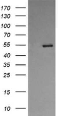 Western Blot: ERp57/PDIA3 Antibody (OTI4D7) - Azide and BSA Free [NBP2-70849] - Analysis of HEK293T cells were transfected with the pCMV6-ENTRY control (Left lane) or pCMV6-ENTRY PDIA3.