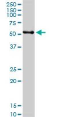 Western Blot: ERp57/PDIA3 Antibody [H00002923-D01P] - Analysis of PDIA3 expression in human kidney.