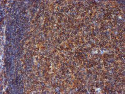 Immunohistochemistry: ERp72 Antibody (OTI2B9) - Azide and BSA Free [NBP2-71488] - Staining of paraffin-embedded Human tonsil using anti-ERp72 mouse monoclonal antibody.