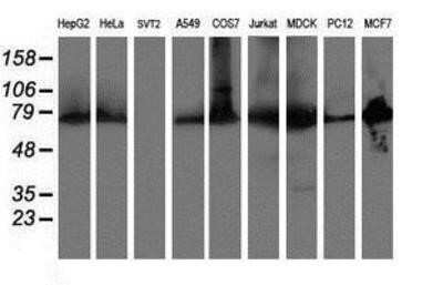 Western Blot: ERp72 Antibody (OTI2B9) - Azide and BSA Free [NBP2-71488] - Analysis of extracts (35ug) from 9 different cell lines by using anti-ERp72 monoclonal antibody.