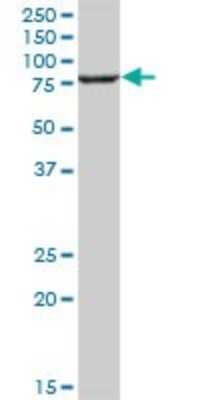 Western Blot: ERp72 Antibody [H00009601-B01P] - Analysis of PDIA4 expression in human liver.
