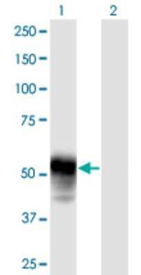 Western Blot: ESAM Antibody [H00090952-B01P] - Analysis of ESAM expression in transfected 293T cell line by ESAM polyclonal antibody.  Lane 1: ESAM transfected lysate(41.20 KDa). Lane 2: Non-transfected lysate.