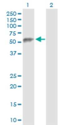 Western Blot: ESAM Antibody [H00090952-D01P] - Analysis of ESAM expression in transfected 293T cell line by ESAM polyclonal antibody.Lane 1: ESAM transfected lysate(41.20 KDa).Lane 2: Non-transfected lysate.