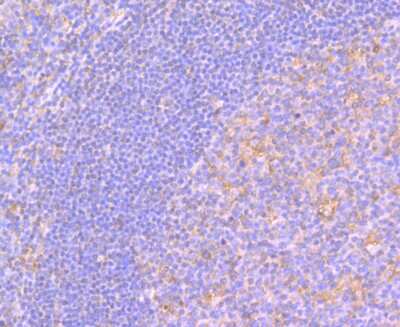 Immunohistochemistry-Paraffin: ESD Antibody (J0-8) [NBP2-66825] - Immunohistochemical analysis of paraffin-embedded human tonsil tissue using anti-ESD antibody. The section was pre-treated using heat mediated antigen retrieval with Tris-EDTA buffer (pH 8.0-8.4) for 20 minutes. The tissues were blocked in 5% BSA for 30 minutes at room temperature, washed with ddH2O and PBS, and then probed with the antibody(at 1/200 dilution, for 30 minutes at room temperature and detected using an HRP conjugated compact polymer system. DAB was used as the chromogen. Counter stained with hematoxylin and mounted with DPX.
