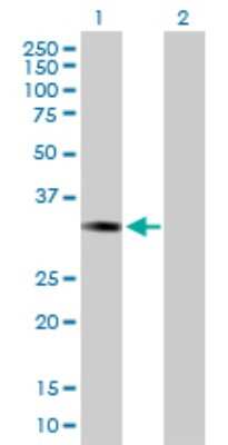 Western Blot: ESD Antibody [H00002098-D01P] - Analysis of ESD expression in transfected 293T cell line by ESD polyclonal antibody.Lane 1: ESD transfected lysate(31.02 KDa).Lane 2: Non-transfected lysate.
