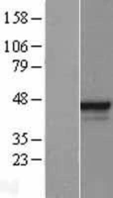 Western Blot: ESE1 Overexpression Lysate (Adult Normal) [NBL1-10230] Left-Empty vector transfected control cell lysate (HEK293 cell lysate); Right -Over-expression Lysate for ESE1.