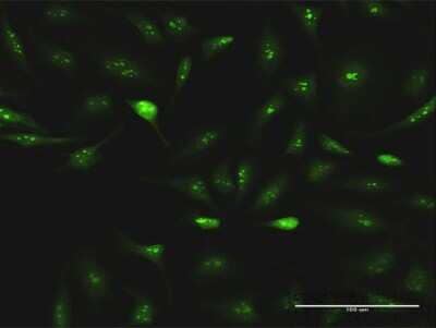 Immunocytochemistry/ Immunofluorescence ESF1 Antibody - Azide and BSA Free