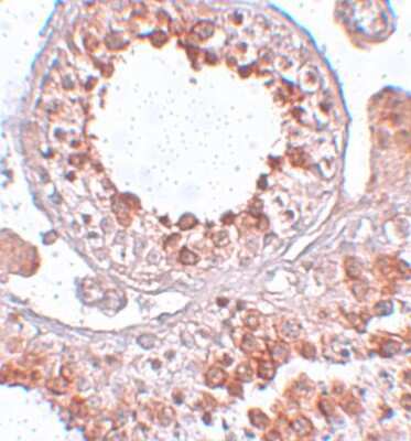 Immunohistochemistry-Paraffin: ESX1 Antibody [NBP1-77114] - Human testis tissue with ESX1 antibody at 2.5 ug/mL.