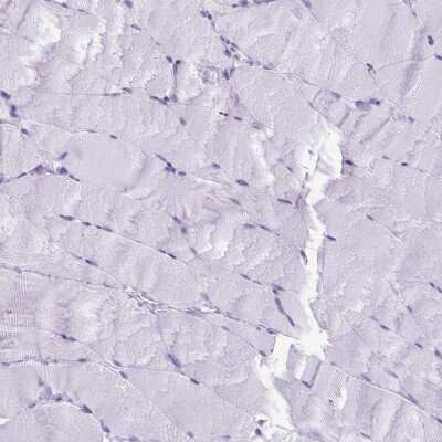 Immunohistochemistry-Paraffin: ESX1 Antibody [NBP2-13973] - Staining of human skeletal muscle shows low expression as expected.