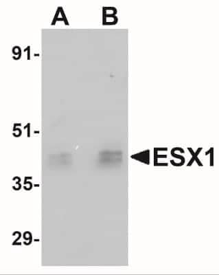 Western Blot: ESX1 Antibody [NBP1-77114] - Human testis tissue lysate with ESX1 antibody at (A) 1 and (B) 2 ug/mL.