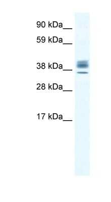 Western Blot: ESX1 Antibody [NBP1-80214] - Human Testis lysate, concentration 2.5 ug/ml.