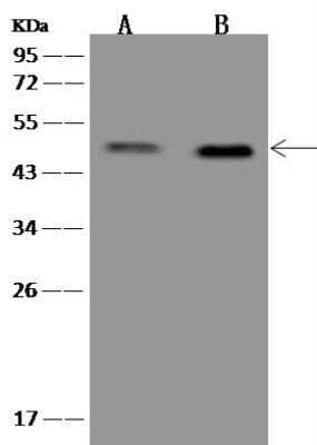 Western Blot: ESX1 Antibody [NBP3-12666] - Lane A: HepG2 Whole Cell LysateLane B: NCI-292 Whole Cell LysateLysates/proteins at 30 ug per lane.SecondaryGoat Anti-Rabbit IgG (H+L)/HRP at 1/10000 dilution.Developed using the ECL technique.Performed under reducing conditions.Predicted band size:44 kDaObserved band size:48 kDa