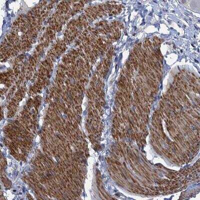 Immunohistochemistry ESYT3 Antibody