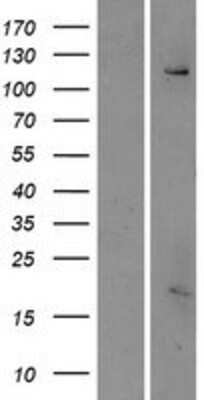 Western Blot ESYT3 Overexpression Lysate