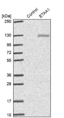 Western Blot ETAA1 Antibody - BSA Free