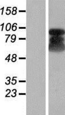 Western Blot ETAA1 Overexpression Lysate