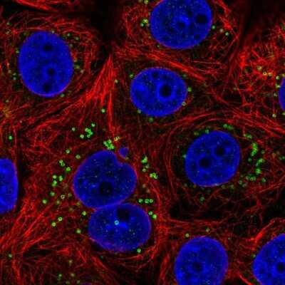 Immunocytochemistry/Immunofluorescence: ETEA Antibody [NBP2-57425] - Staining of human cell line MCF7 shows localization to lipid droplets.