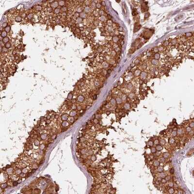 Immunohistochemistry: ETEA Antibody [NBP2-68916] - Immunohistochemical staining of human testis shows strong positivity in seminiferous cells and Leydig cells.