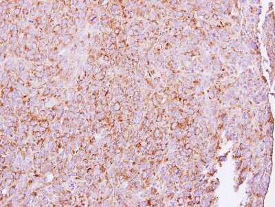 Immunohistochemistry-Paraffin ETEA Antibody