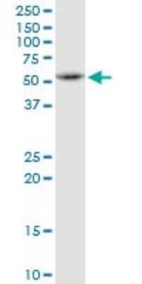 Western Blot: ETEA Antibody [H00023197-B01P] - Analysis of FAF2 expression in Jurkat.