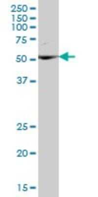 Western Blot: ETEA Antibody [H00023197-B01P] - Analysis of UBXD8 expression in rat brain.