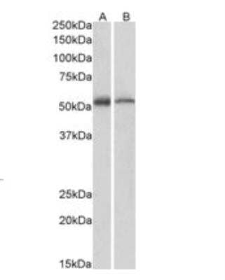 Western Blot: ETEA Antibody [NB100-1296] - Staining of Human (A) and Mouse (B) Thymus lysate (35ug protein in RIPA buffer). Primary incubation was 1 hour. Detected by chemiluminescence.