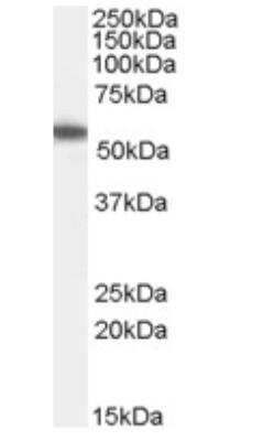 Western Blot: ETEA Antibody [NB100-1296] -  Staining (0.3ug/ml) of Jurkat lysate (RIPA buffer, 35ug total protein per lane). Primary incubated for 1 hour. Detected by chemiluminescence.