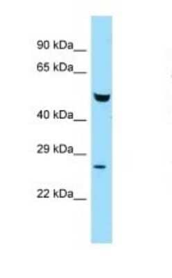 Western Blot: ETEA Antibody [NBP1-98272] - Titration: 1.0 ug/ml Positive Control: Mouse Liver.