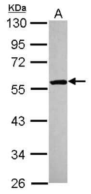 Western Blot ETEA Antibody