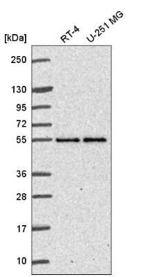 Western Blot: ETEA Antibody [NBP2-57425] - Western blot analysis in human cell line RT-4 and human cell line U-251 MG.