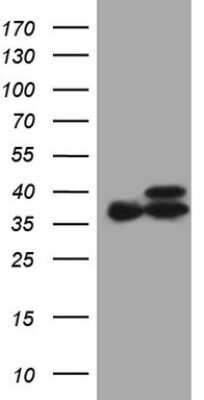 Western Blot: ETFA Antibody (OTI5C4) - Azide and BSA Free [NBP2-70693] - Analysis of HEK293T cells were transfected with the pCMV6-ENTRY control (Left lane) or pCMV6-ENTRY ETFA.