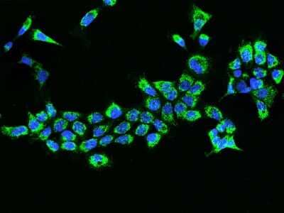 Immunocytochemistry/Immunofluorescence: ETFB Antibody [NBP2-97524] - Immunofluorescence staining of ETFB in A431 cells. Cells were fixed with 4% PFA, permeabilzed with 0.1% Triton X-100 in PBS, blocked with 10% serum, and incubated with rabbit anti-Human ETFB polyclonal antibody (dilution ratio 1:200) at 4C overnight. Then cells were stained with the Alexa Fluor(R)488-conjugated Goat Anti-rabbit IgG secondary antibody (green) and counterstained with DAPI (blue).Positive staining was localized to Cytoplasm.