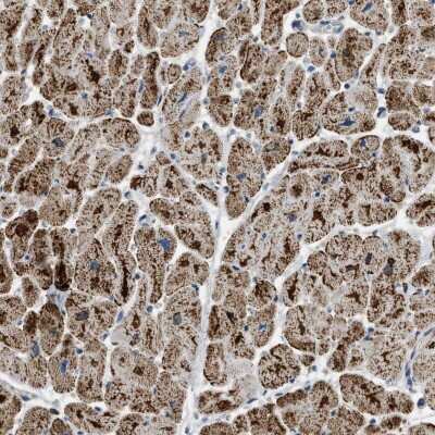 <b>Independent Antibodies Validation. </b>Immunohistochemistry-Paraffin: ETFB Antibody [NBP1-86040] - Staining of human heart muscle shows cytoplasmic positivity with a granular pattern in myocytes.