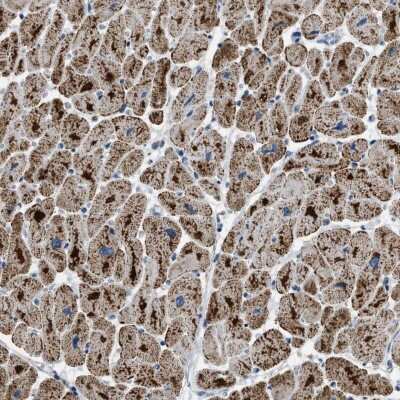 Immunohistochemistry-Paraffin: ETFB Antibody [NBP1-89455] - Staining of human heart muscle shows cytoplasmic positivity with a granular pattern in myocytes.
