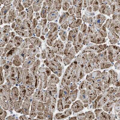 Immunohistochemistry-Paraffin: ETFB Antibody [NBP1-89545] - Staining of human heart muscle shows cytoplasmic positivity with a granular pattern in myocytes.