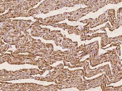 Immunohistochemistry-Paraffin: ETFB Antibody [NBP2-97524] - Immunochemical staining of human ETFB in cynomolgus heart with rabbit polyclonal antibody at 1:500 dilution, formalin-fixed paraffin embedded sections.