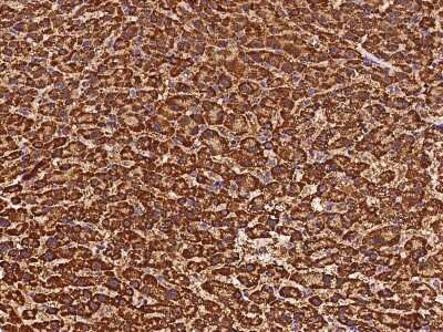 Immunohistochemistry-Paraffin: ETFB Antibody [NBP2-97524] - Immunochemical staining of human ETFB in human liver with rabbit polyclonal antibody at 1:500 dilution, formalin-fixed paraffin embedded sections.