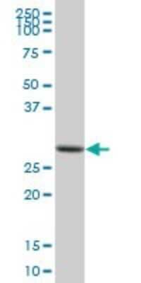 Western Blot: ETFB Antibody [H00002109-B01P] - Analysis of ETFB expression in human liver.