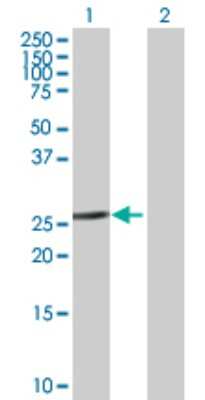 Western Blot: ETFB Antibody [H00002109-B01P] - Analysis of ETFB expression in transfected 293T cell line by ETFB polyclonal antibody.  Lane 1: ETFB transfected lysate(28.05 KDa). Lane 2: Non-transfected lysate.