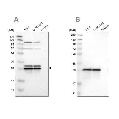 Western Blot ETFB Antibody - BSA Free