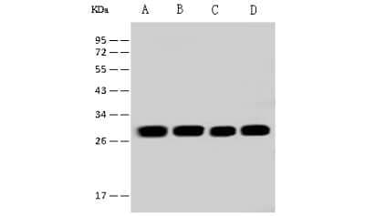 Western Blot: ETFB Antibody [NBP2-97524] - Anti-ETFB rabbit polyclonal antibody at 1:500 dilution. Lane A: MOLT4 Whole Cell Lysate Lane B: Mouse liver tissue lysate Lane C: U-251 MG Whole Cell Lysate Lane D: NIH-3T3 Whole Cell Lysate Lysates/proteins at 30 ug per lane. Secondary Goat Anti-Rabbit IgG (H+L)/HRP at 1/10000 dilution. Developed using the ECL technique. Performed under reducing conditions. Predicted band size: 27 kDa. Observed band size: 27 kDa