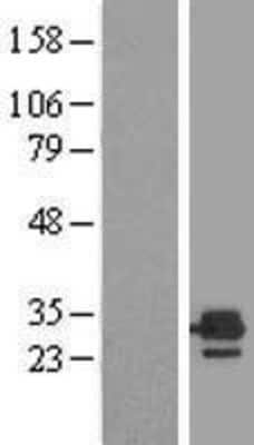Western Blot: ETFB Overexpression Lysate (Adult Normal) [NBL1-10350] Left-Empty vector transfected control cell lysate (HEK293 cell lysate); Right -Over-expression Lysate for ETFB.
