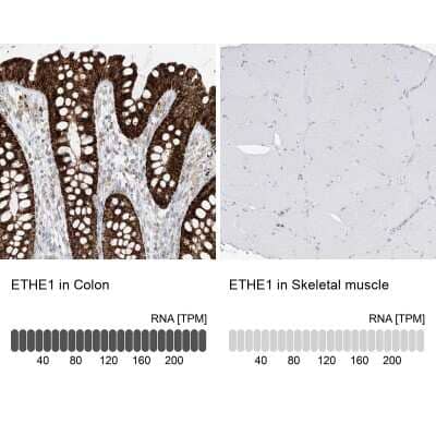 Immunohistochemistry-Paraffin: ETHE1 Antibody [NBP1-81689] - Analysis in human colon and skeletal muscle tissues. Corresponding ETHE1 RNA-seq data are presented for the same tissues.